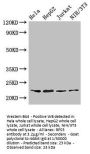 RPS5 Antibody