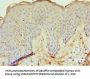 ECE1 Antibody