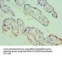 ECE1 Antibody
