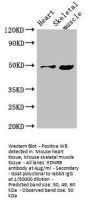 EDNRB Antibody