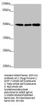 EEF1A2 Antibody