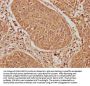 EIF2AK2 Antibody