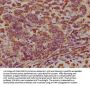 EIF2AK3 Antibody