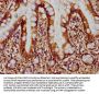 EIF2AK3 Antibody