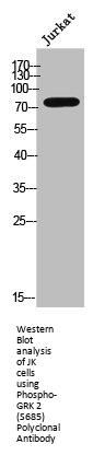 Phospho-ADRBK1 (S685) Antibody