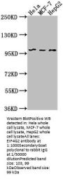 EIF4G2 Antibody