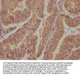 EIF4G2 Antibody