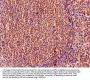 EIF5A Antibody