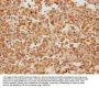 EIF5A Antibody