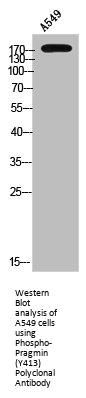 Phospho-SGK223 (Y413) Antibody