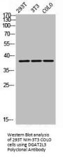 AWAT1 Antibody