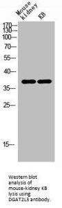AWAT1 Antibody