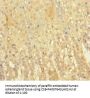 EML2 Antibody