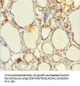 EML2 Antibody
