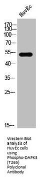 Phospho-DAPK3 (T265) Antibody