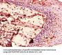 ENTPD8 Antibody