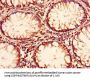 ENTPD8 Antibody