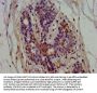 EPRS Antibody