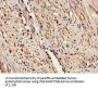 ERAP1 Antibody