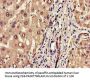 ERAP1 Antibody
