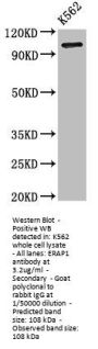 ERAP1 Antibody