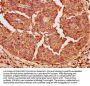 ERAP2 Antibody