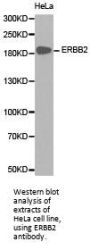 ERBB2 Antibody