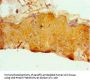 ERCC2 Antibody