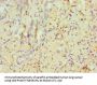 ERCC2 Antibody