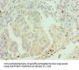 ERCC2 Antibody
