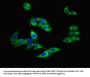 TRPM2 Antibody