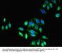 TRPM2 Antibody