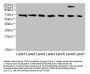 TRPM2 Antibody