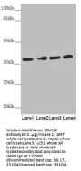 ERLIN2 Antibody