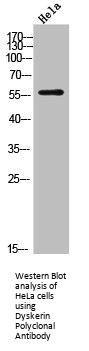 DKC1 Antibody