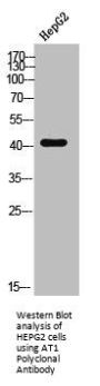 AGTR1 Antibody