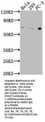 EXOC7 Antibody