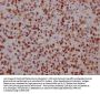FABP4 Antibody