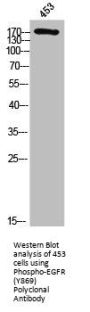 Phospho-EGFR (Y869) Antibody