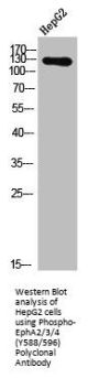 Phospho-EPHA2/EPHA3/EPHA4 (Y588/596) Antibody