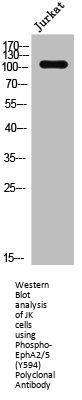 Phospho-EPHA2/EPHA5 (Y594) Antibody