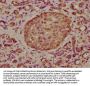 TCAF2 Antibody