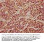 TCAF2 Antibody