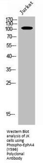 Phospho-EPHA4 (Y596) Antibody