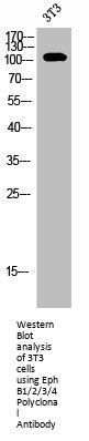 EPHB1/EPHB2/EPHB3/EPHB4 Antibody