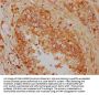 FAM13A Antibody