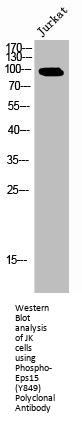 Phospho-EPS15 (Y849) Antibody