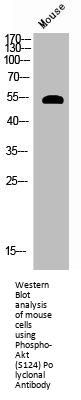 Phospho-AKT1 (S124) Antibody