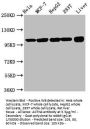 ACTN4 Antibody
