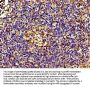 ACTN4 Antibody